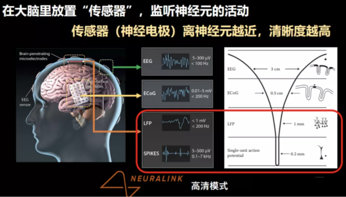 美国称考虑对“脑机接口”技术出口进行限制